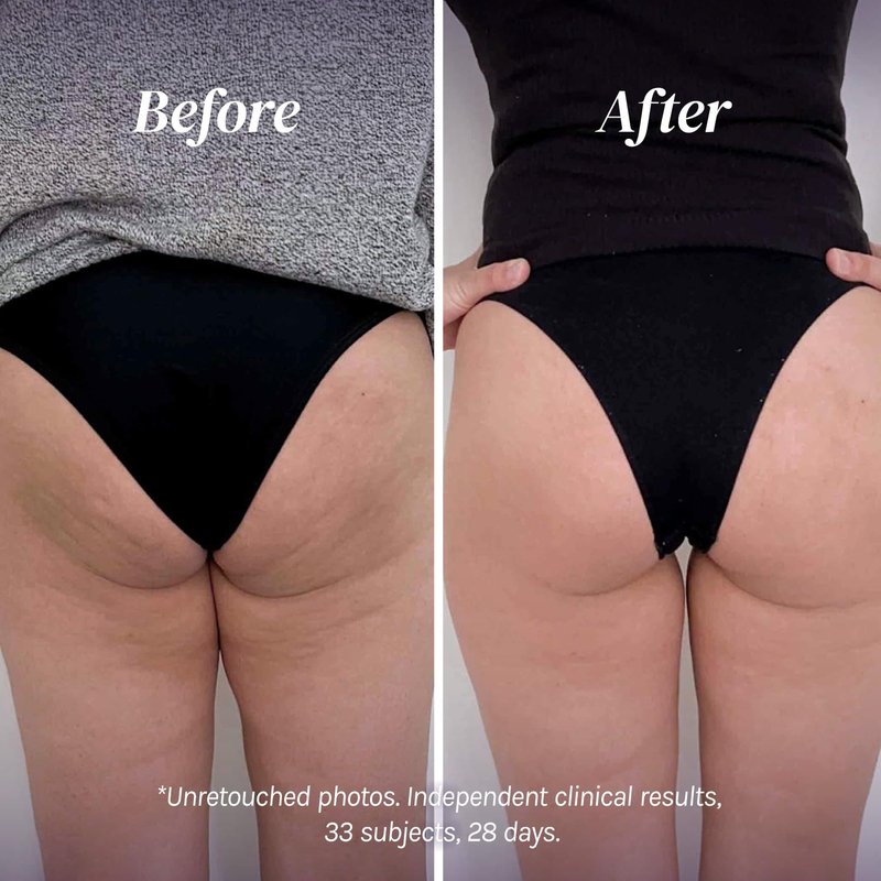 Divine Derriere Brazilian Body Butter Cream, Lift and Firm Body Cream with Volufiline Helps Reduce the Appearance of Cellulite for a Lifted and Firm-looking Derriere, Bum Bum Cream, 50ml