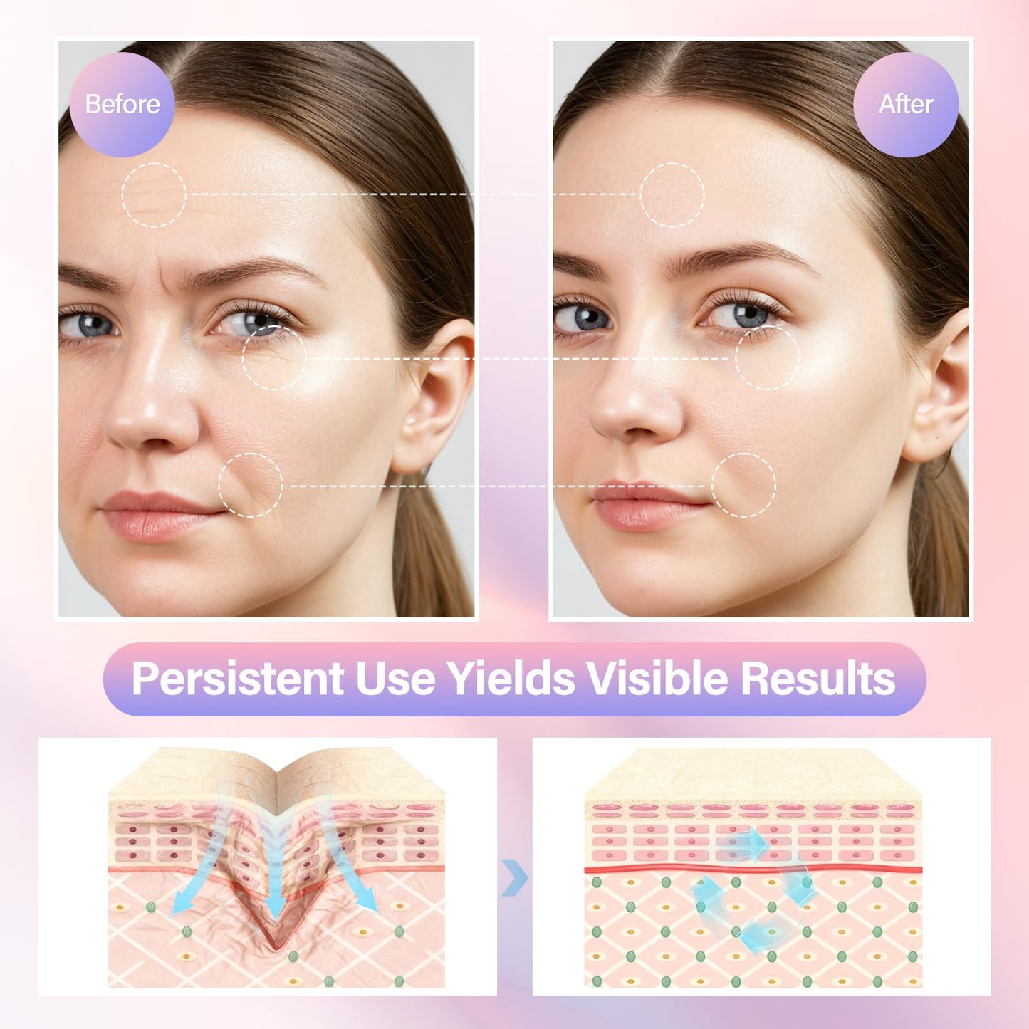 Neck and Face Care Device for Home Daily Use, Skin Care Tool, Wrink-le Improve, Firm, Tightening and Smooth White
