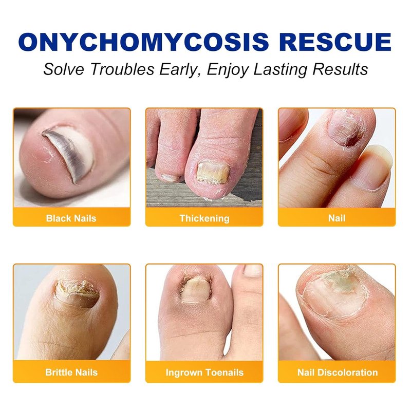 Extra Strength Toenail Treatment | 8-Hour Overnight Repair for Ingrown Nails, Strengthens Brittle Nails, Hypoallergenic (64 Patches)