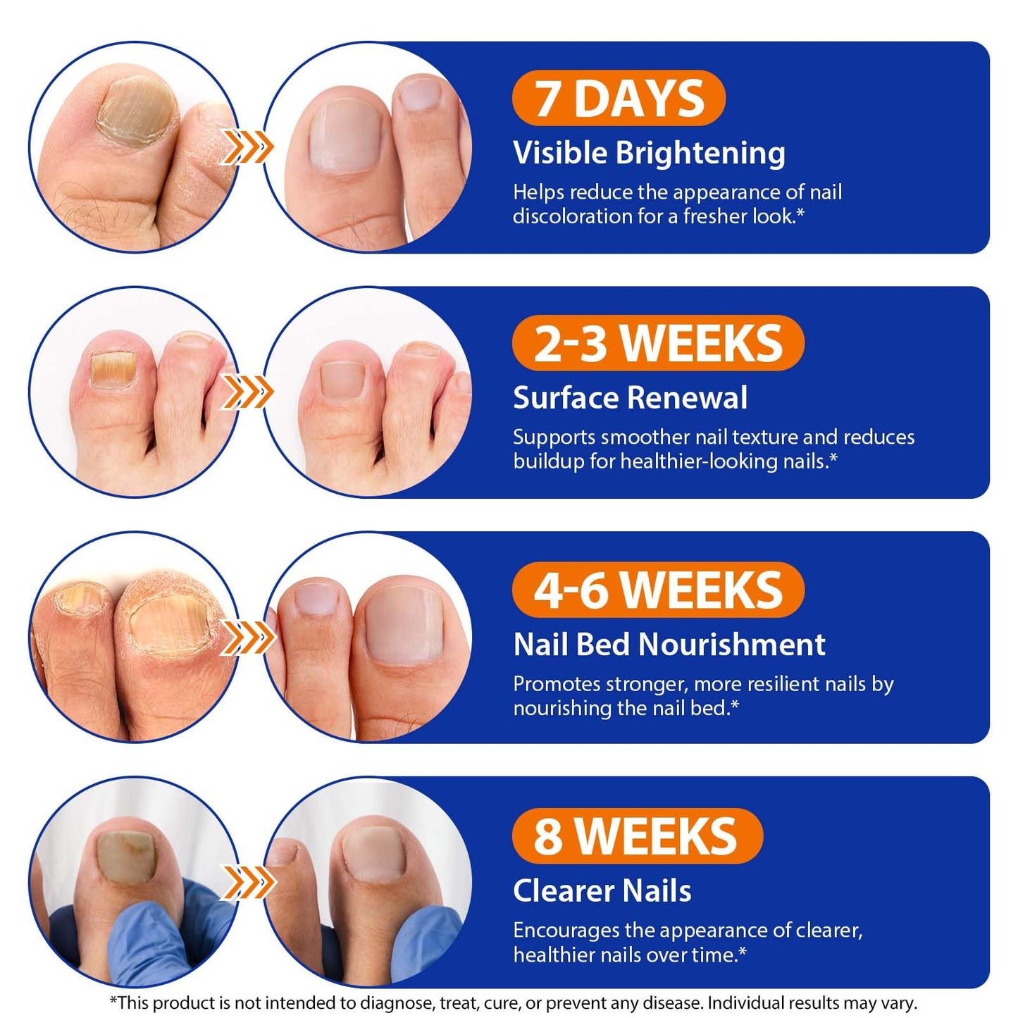 Toenail Treatment Extra Strength - 32 Pcs Nighttime Nail Patches, Overnight Toe Nail Treatments for Damaged Nails Foot Nails Repair and Care, 8-Hour Restores Healthy Appearance (2PCS)
