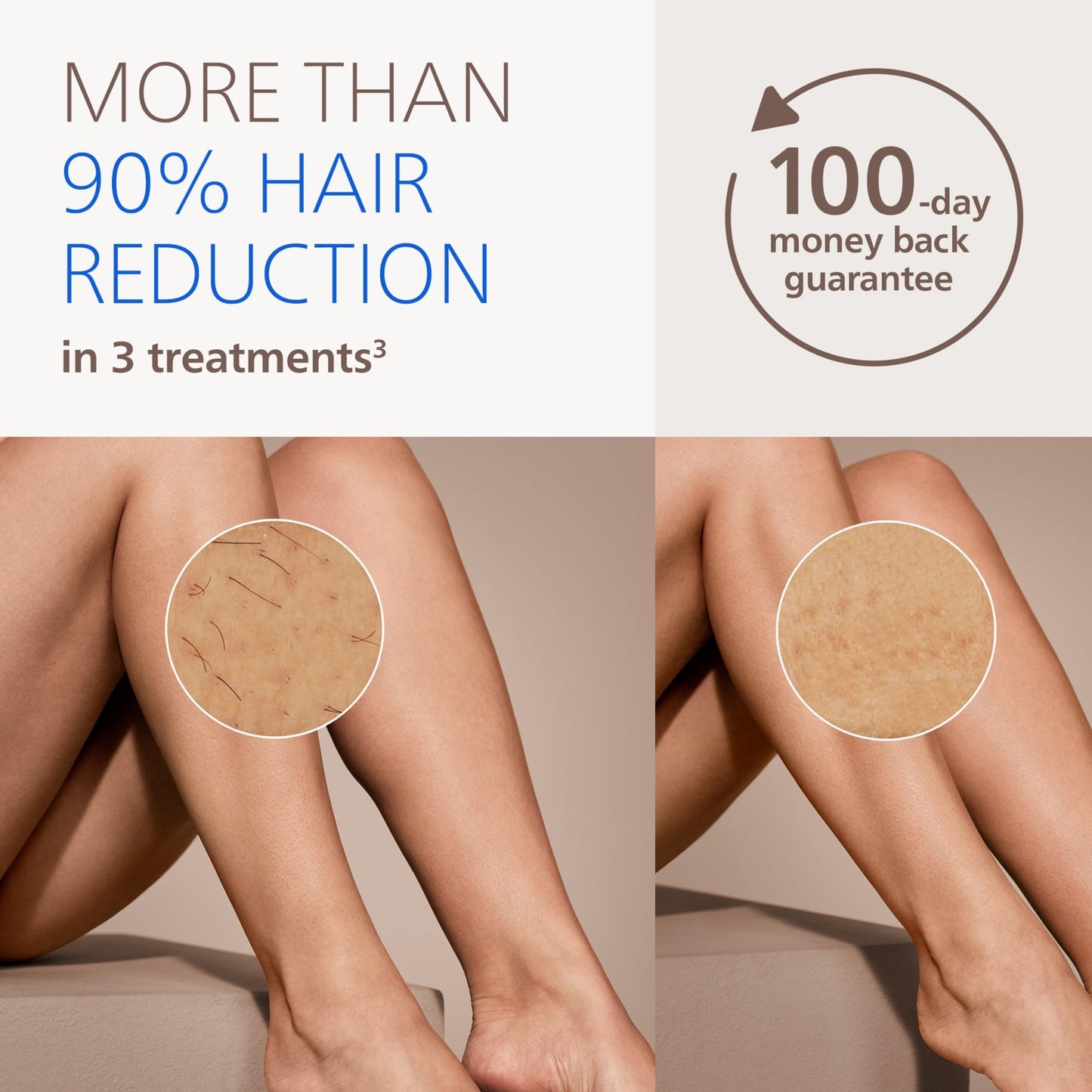 Philips Lumea 7000 Series IPL Hair Removal Device - Permanent Laser Hair Reduction for Women & Men, Easy and Comfortable Use at Home, SenseIQ, Uniquely Curved Attachment for Body, BRI931/03