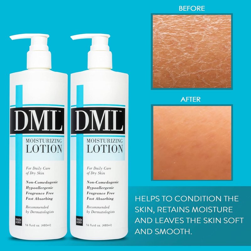 Moisturizing Lotion - Hydrating Hand & Body Lotion for Dry Skin | Unscented, Hypoallergenic, 16 oz (Pack of 2)