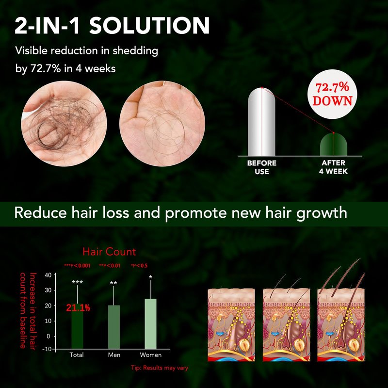 Minoxidil Spray Kit for Men and Women 5% Minoxidil Hair & Beard Growth Oil Kit, Advanced Hair Regrowth Serum Topical Solution Minoxidil Spray Treatment for Hair Loss, Thinning, Hair Thicker 2.02 fl.oz