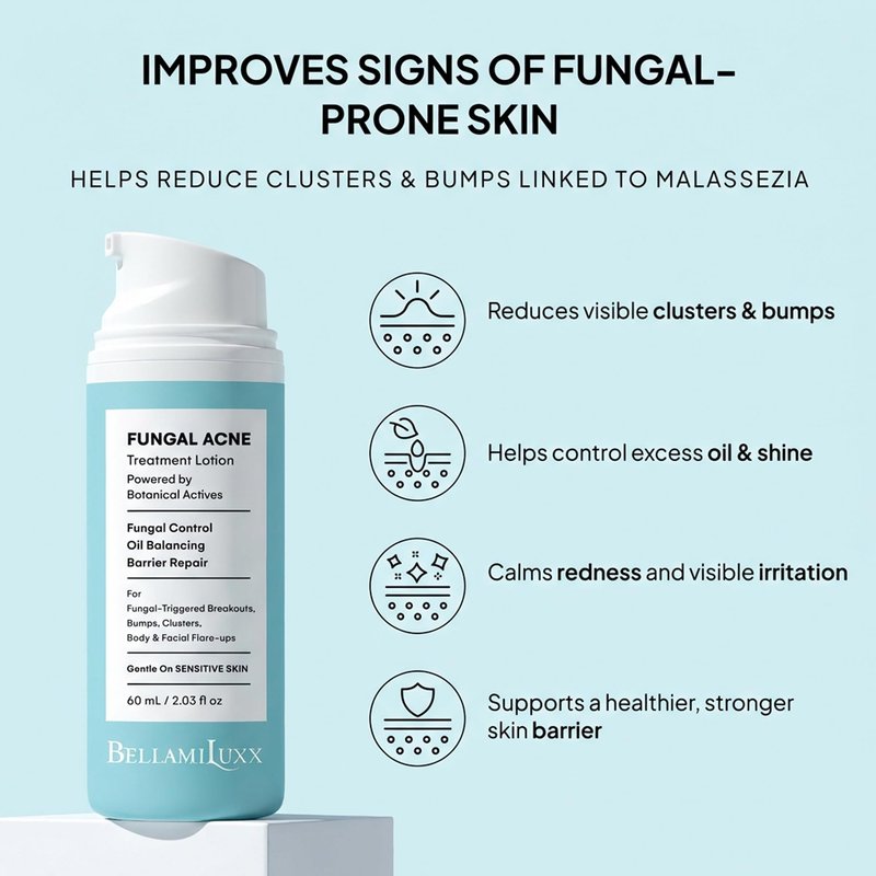 BellamiLuxx Fungal Acne Treatment Lotion: Effective Face & Body Pimple Cream for Bumps, Clusters, Itch & Redness – Fungal Prone Skin Acne Treatment Moisturizer for Teens & Adults with Natural Actives