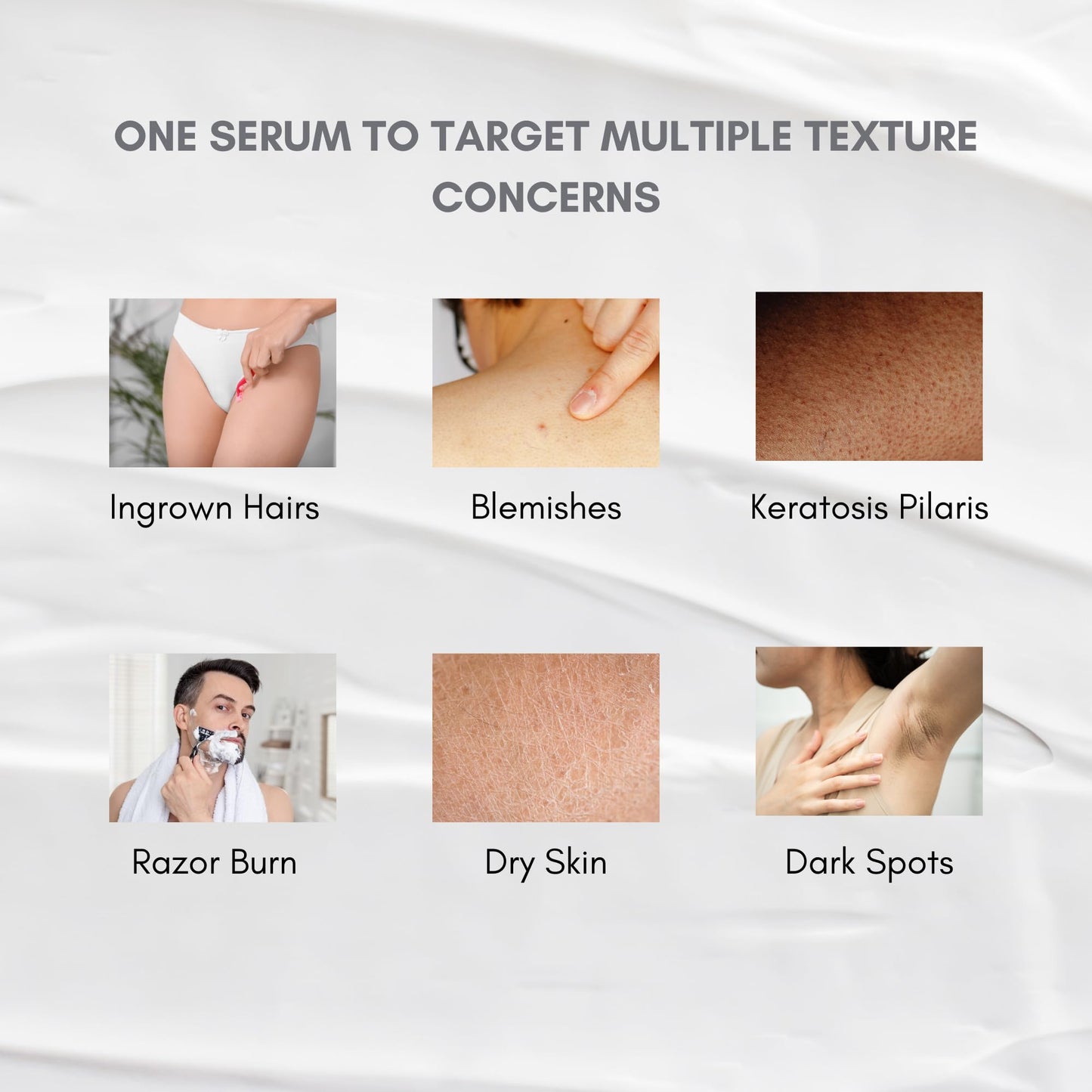 klarifyScience KP Treatment Serum - Triple Acid Complex (AHA + BHA + PHA) for Keratosis Pilaris | Gentle Daily Face and Body Serum for Rough Bumpy Skin, Strawberry Legs & Ingrown Hairs | 4 fl oz