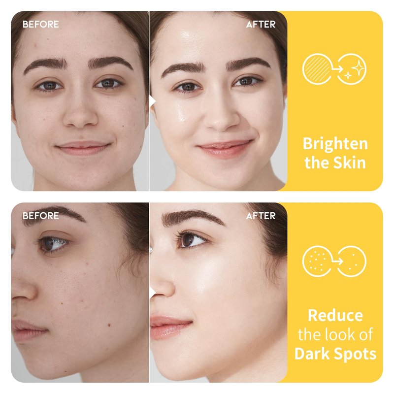 #OOTD Vitamin C Toner for Face – Formula with Niacinamide, Heartleaf, and Squalane – 8.45 FI Oz