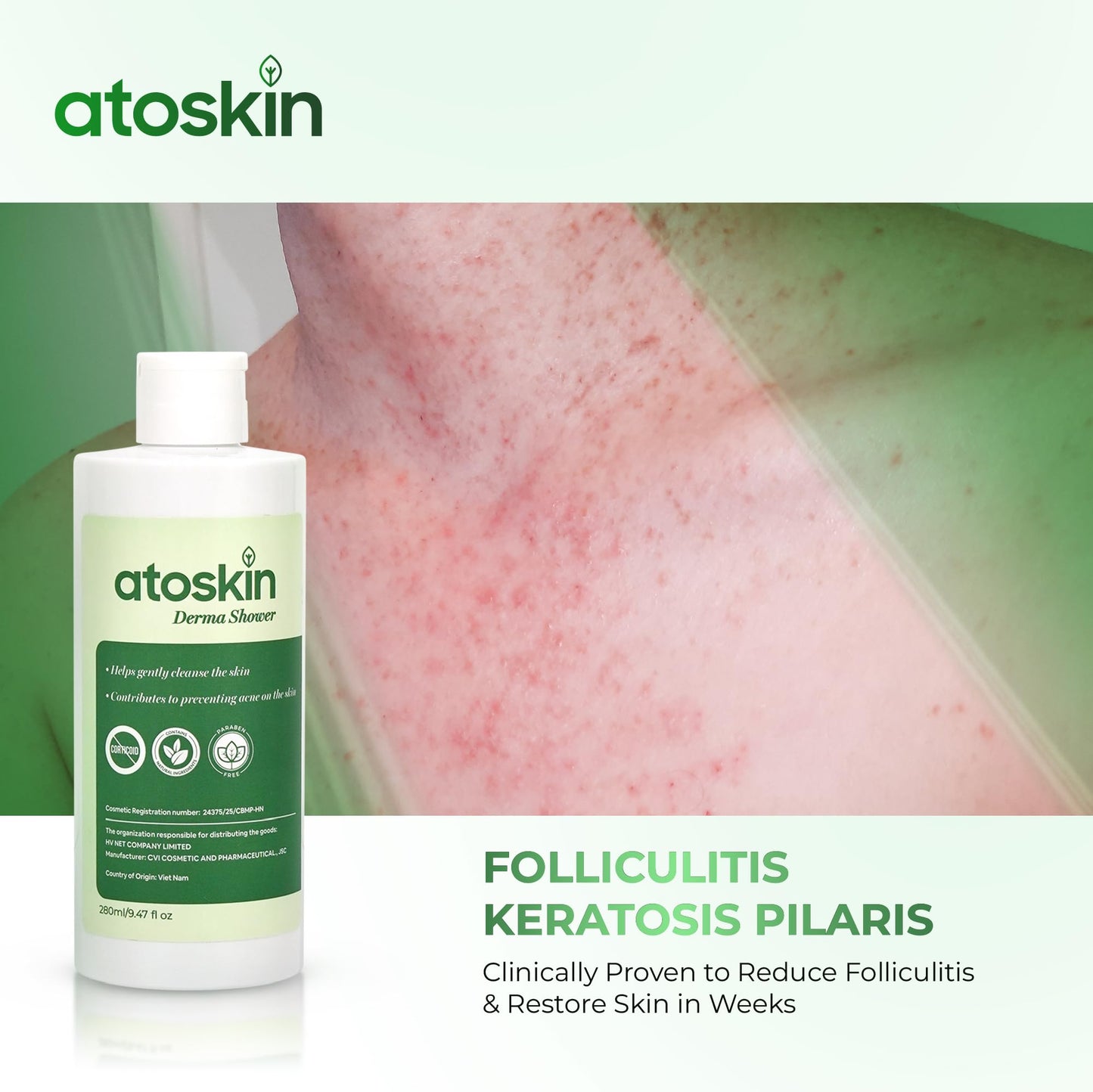 Atoskin Derma Shower – Advanced Folliculitis Body Wash with Rosemary & Ricobio JA7 Herbal Extracts, Reduce Back Acne & Keratosis Pilaris, Gentle Formula for Sensitive Skin (9.47 oz)