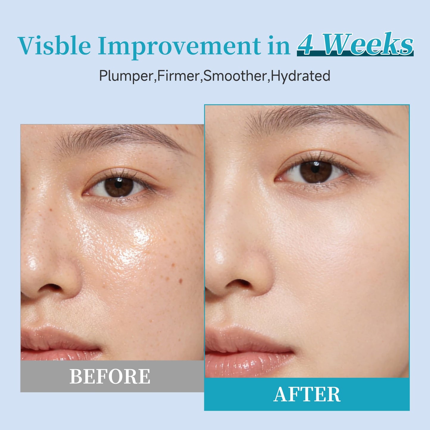 BACHERI Collagen Peptide Anti-Aging Serum with PDRN – Triple Collagen, Peptide Complex & Botanical Extracts for Firming, Hydration & Skin Barrier Repair – Ampoule Serum Set 1.5ml x 30