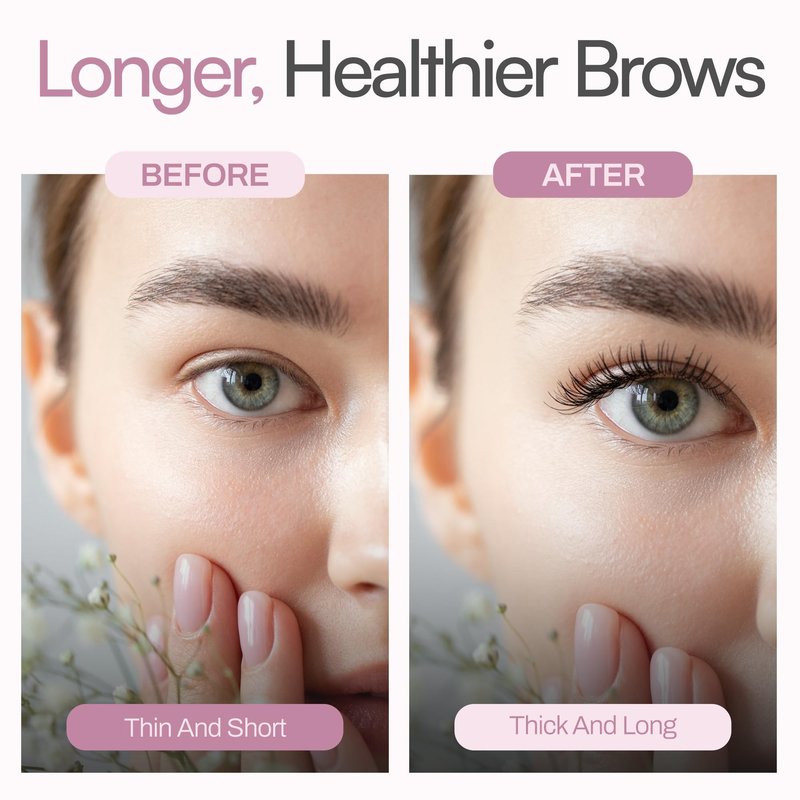 Foltene Eyelash & Eyebrow Treatment - Lash and Brow Serum with Applicator - Stimulate Growth for Thicker Longer Fuller Eyelashes & Eyebrows - Strengthening & Protective Effect - Nutrition Conditioner