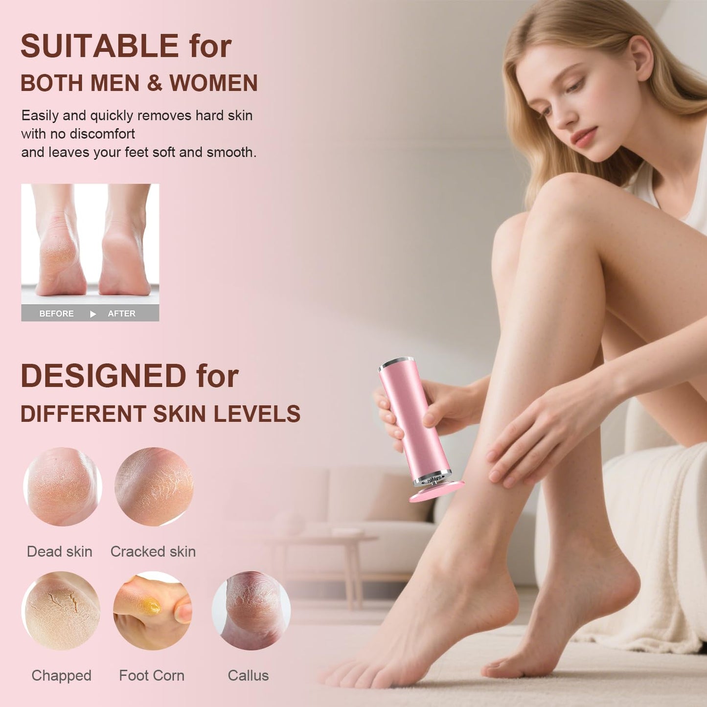 10-in-1 Electric Foot Callus Remover, Adjustable Speed Electric Callus Remover for Feet with 60 Sanding Pads, Foot Callus Remover, Heel Scraper for Cracked Heels (Rose Pink)