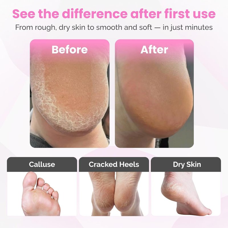 Electric Foot Callus Remover Tool - Aluminum Body with 60 Discs, Adjustable Speed, 800 RPM for Smooth Exfoliation
