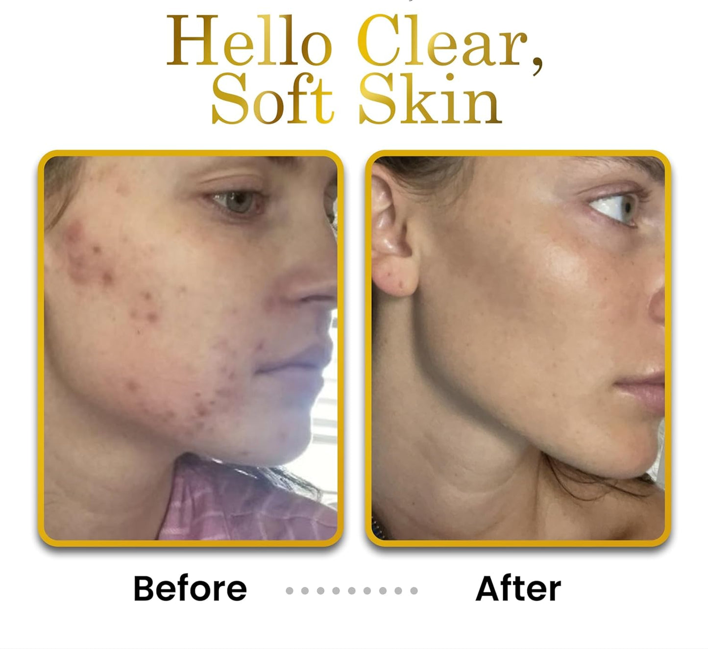 Hyaluronic Acid Moisturizer - Non-Greasy Coconut-Scented Lotion | Organic Anti-Aging Facial Cream