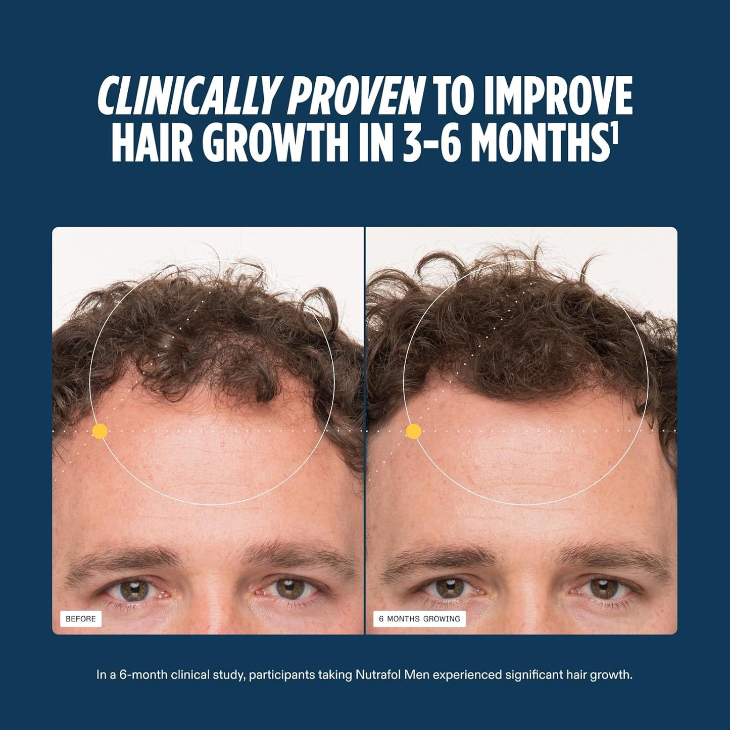 Nutrafol Men's Hair Growth Supplements - Clinically Tested for Thicker Hair & Scalp Coverage | 1 Month Supply