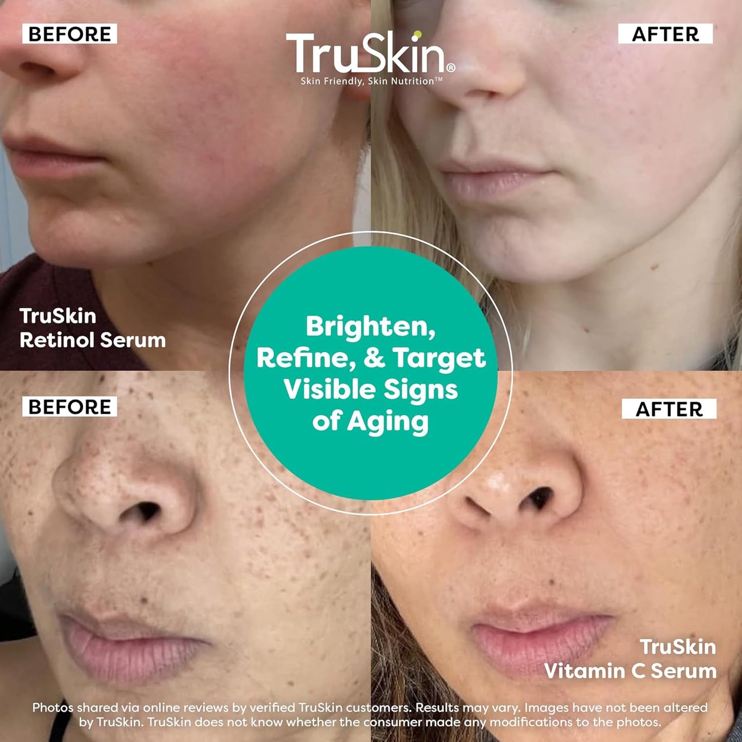 TruSkin Face Serum Duo - Vitamin C & Retinol Anti-Aging Skincare - Brightening & Smoothing | 1 fl oz Each