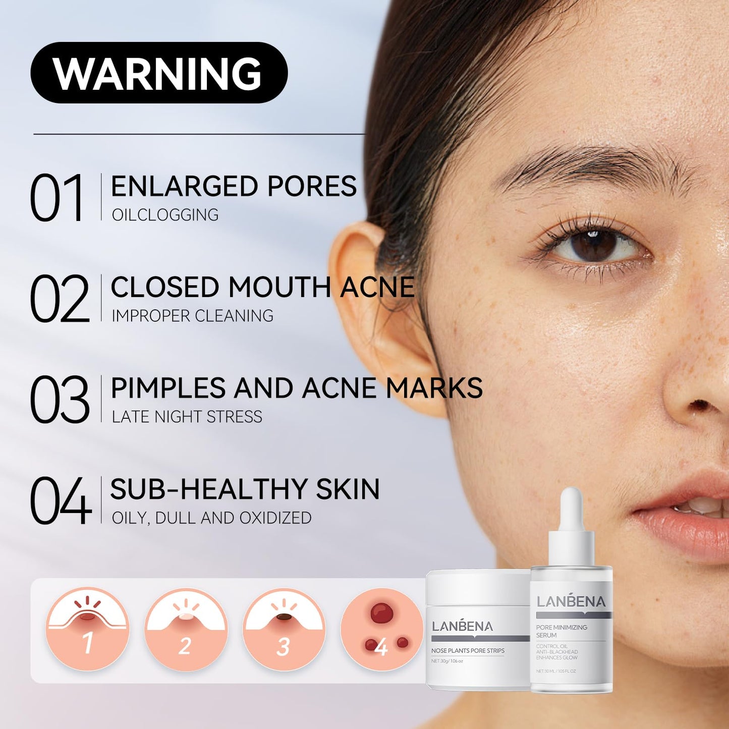 LANBENA 3-in-1 Blackhead Removal Set - Pore Strips (30g), Pore Minimizing Serum (30ml) & Removal Paper - Mask for Face, Minimizes Pores & Leaves Skin Fresh & Clean, Blackhead Remover