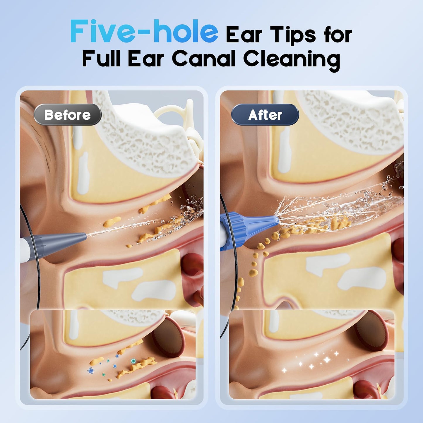 Ear Wax Removal, Electric Ear Cleaning Kit with Light, FSA-HSA-Eligible, Ear Irrigation Kit with 4 Pressure Modes, Safe and Effective Ear Flush Kit with Ear Cleaner - Includes Basin, Towel & 15 Tips