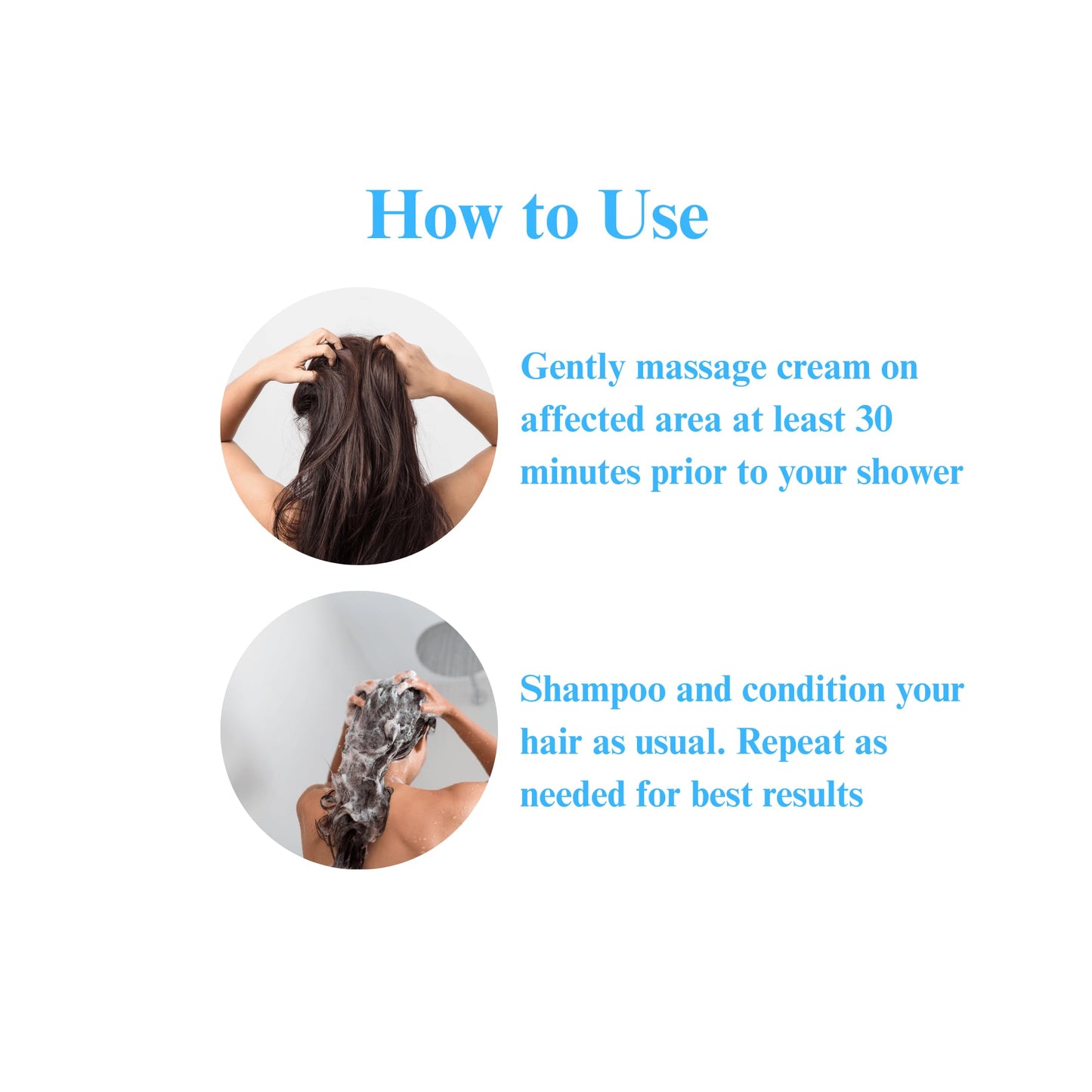 AmFil Skincare Dry Scalp Cream - Soothes Itchiness and Reduces Flakes for Dry, Sensitive Scalp - Gentle Relief for Eczema, Psoriasis and Seborrheic Dermatitis, 4 oz, 1-Pack