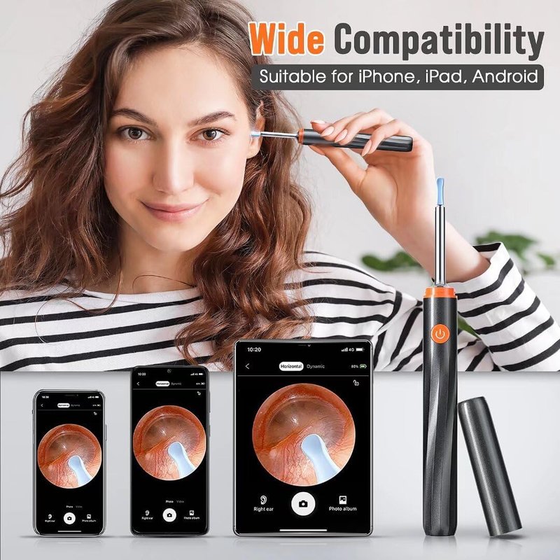Ear Wax Removal Tool Camera - Ear Cleaner with 1080P HD Camera, Otoscope with Light, Earwax Removal Kit for iPhone, iPad, Android Phones (Orange)