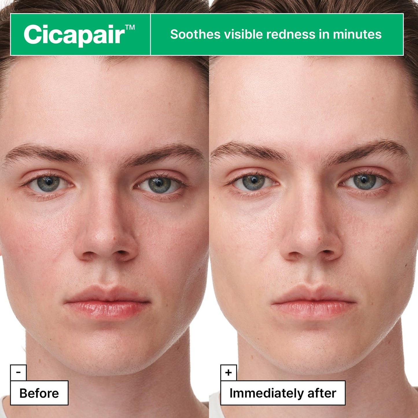 Dr.Jart+ Cicapair Sensitive Skin Serum | Korean Face Mask for Redness Relief with Centella Asiatica - 5 Sheets