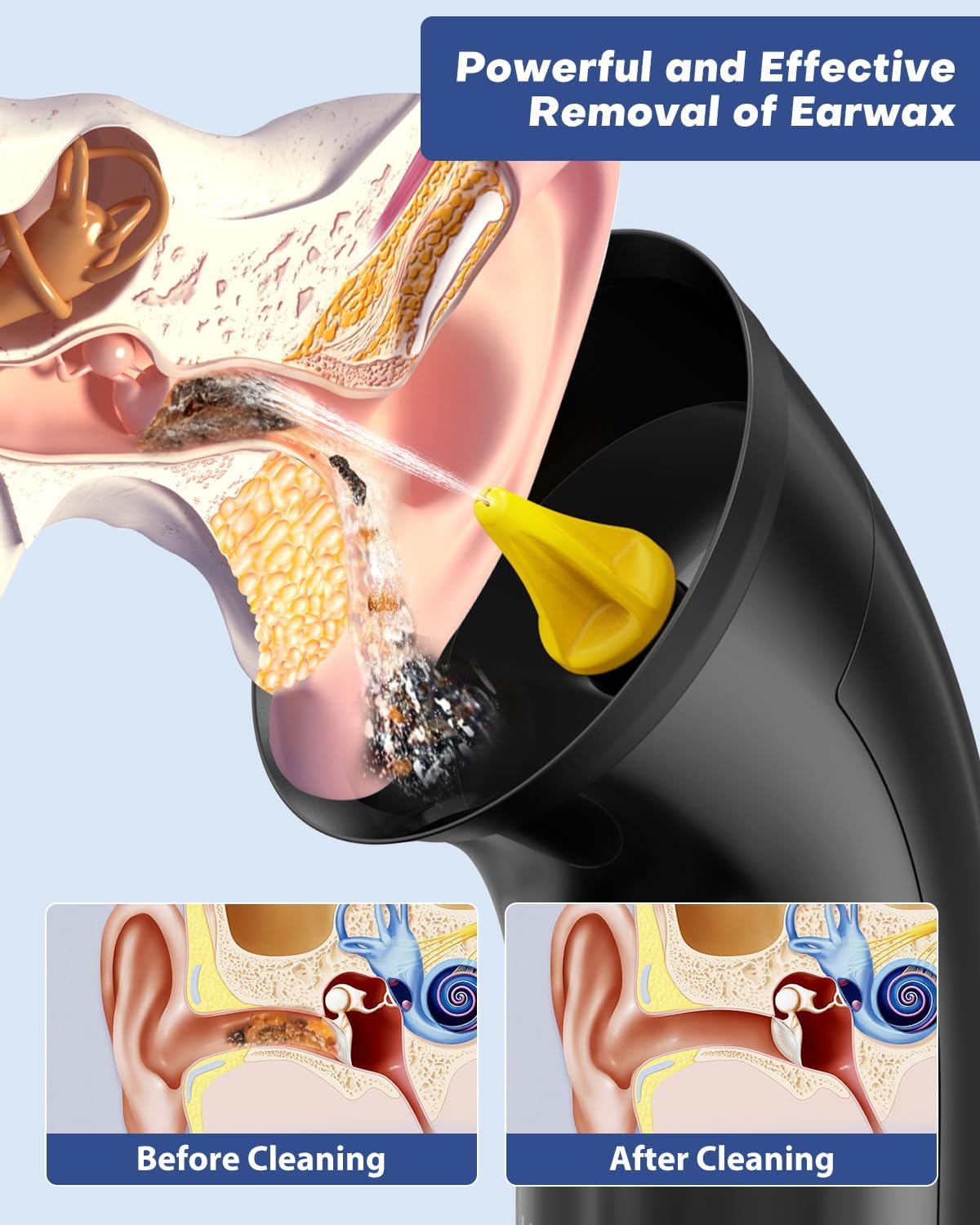 Ear Wax Removal Kit - Dual Water Tank Design with 4 Pressure Settings | 250ML Capacity, 8 Soft Earbuds, Type-C Charging, IPX7 Waterproof