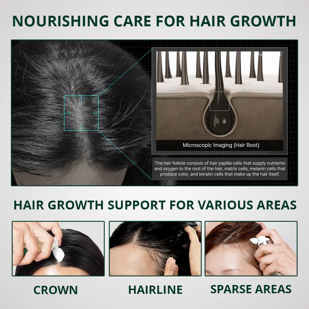 ViveLab Hair Growth Serum - Micro Foam Scalp Treatment with Biotin, Rosemary Oil & Caffeine | Vegan, Clinically Tested for Thicker Hair