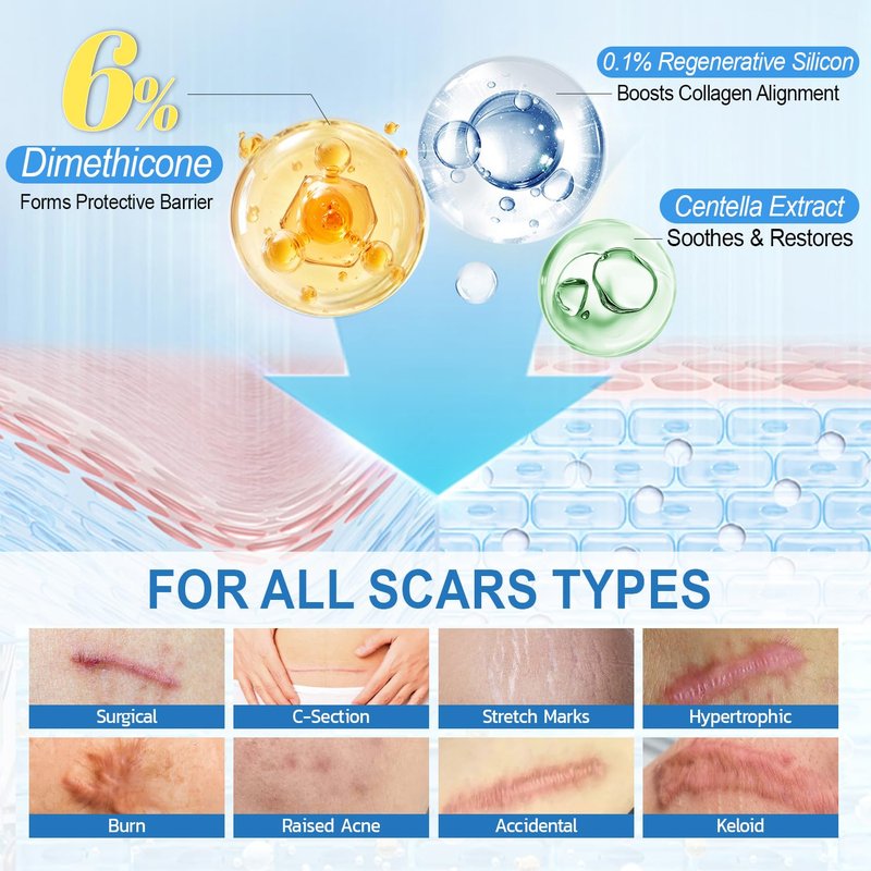 MythosFlow Scar Cream 6% Dimethicone Silicone Cream for Scars, Advanced Scar Removal Cream for Surgical, C-Section, Acne, Keloids, Burns, Old & New Scars, with Scar Tape, 1.69 fl.oz + 1.5m