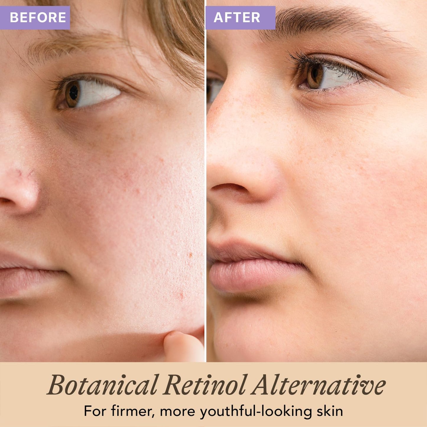 Bio Retinol Alternative Bakuchiol Serum - Smooths Skin & Reduces Fine Lines