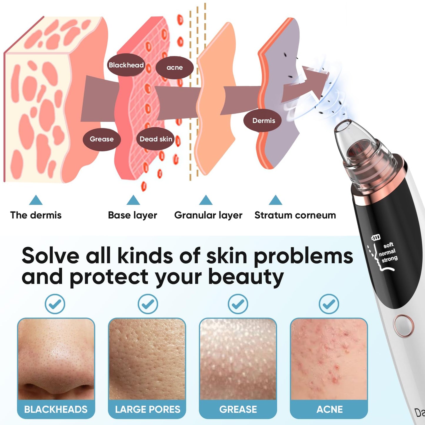 Blackhead Remover Pore Vacuum (Snow White)