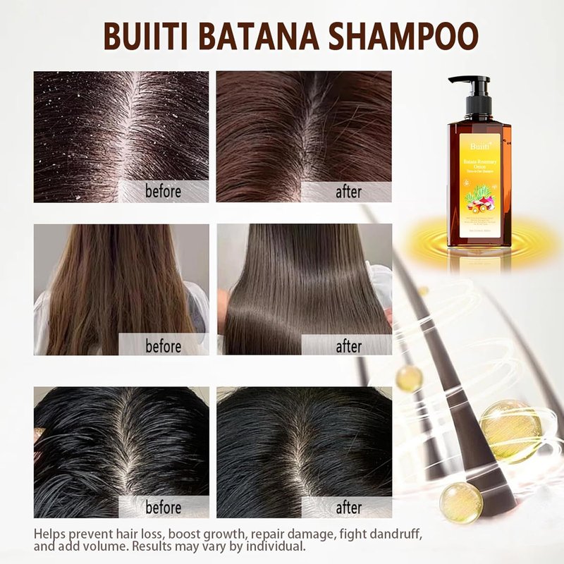 Batana Oil Shampoo for Hair Growth - Rosemary & Onion Infused, Anti-Hair Loss Treatment | 10.14 fl oz (2PCS)