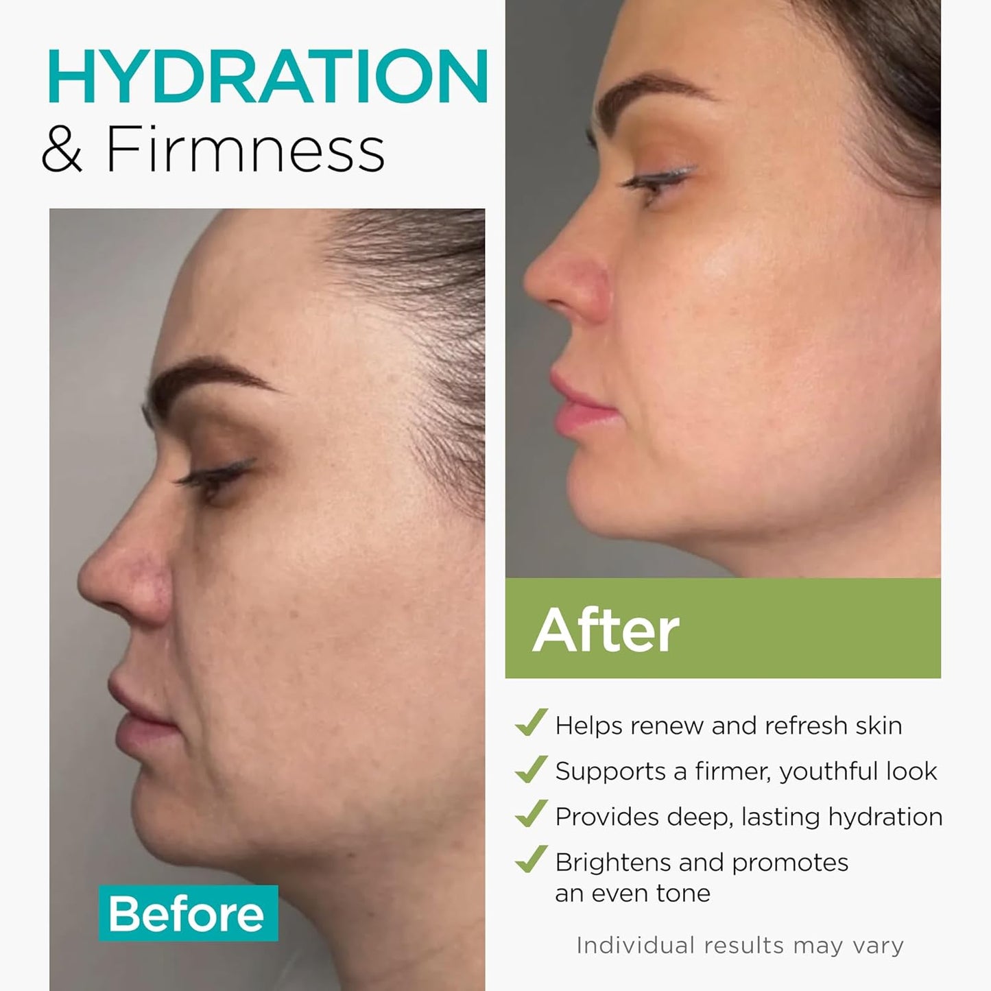 Collagen Cream with Retinol & Hyaluronic Acid - Anti-Aging Moisturizer for All Skin Types | 1.7 Oz