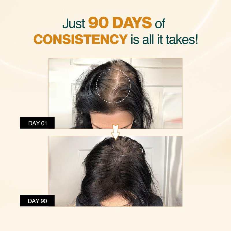 Nourish Mantra - Advanced Hair Growth Serum For Women & Men | Made With Redensyl, Anagain, Procapil & Rice Water | Prevents Hair Fall & Thinning | Promotes Hair Regrowth 25 ml
