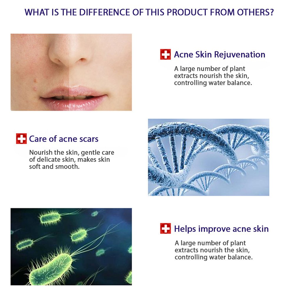 (0BQY0733) Acne Removal Rejuvenation Moisturizing Mask