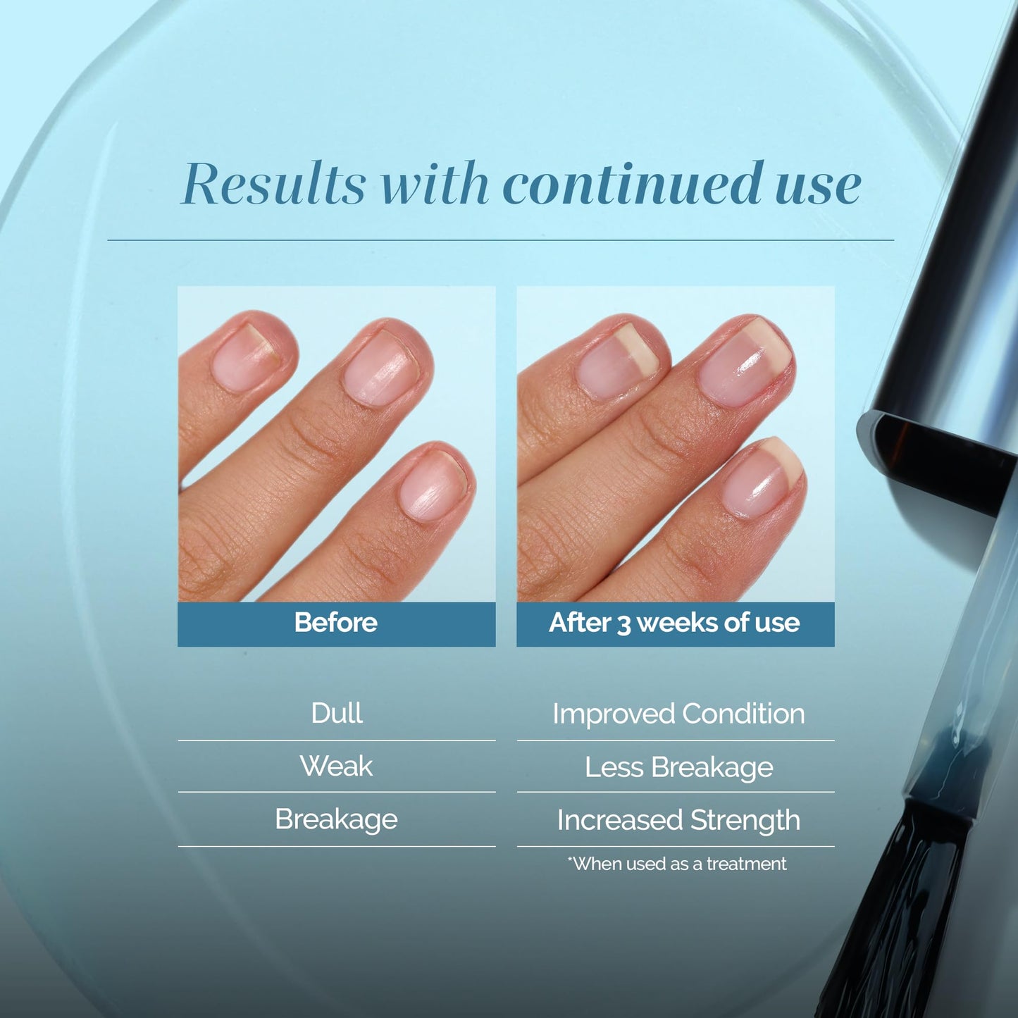 LONDONTOWN Get Strong Nail Hardener - Nail Strengthener Growth Treatment for Damaged Nails, Conditioning Nail Care for Long Healthy Nails, .40fl oz
