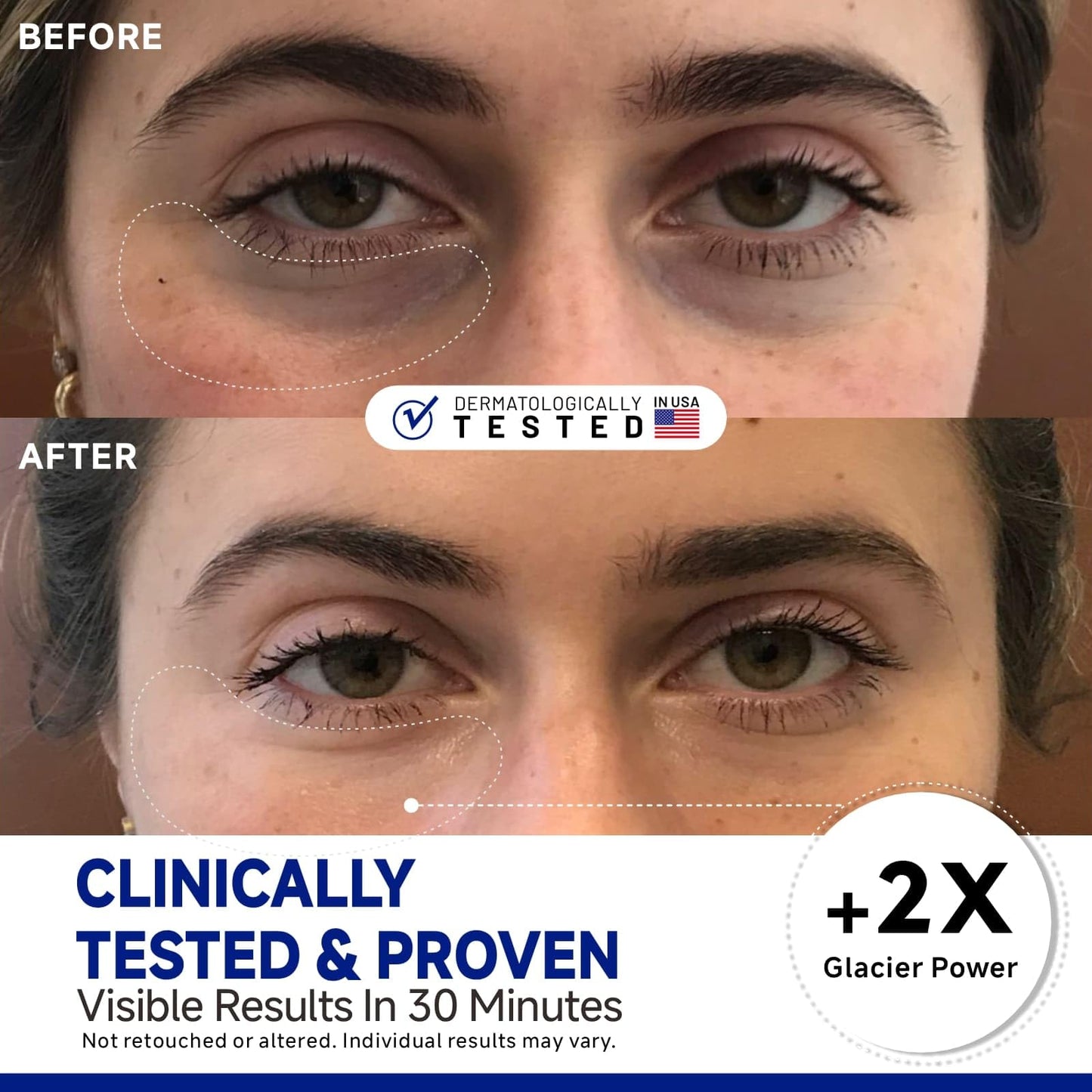 Dr Vincent Peptide Cooling Under Eye Patches, Soothing Eye Patches Instant Reduces Dark Circles and Puffiness, Calming Under Eye Mask with Glacial Water for Bags Treatment, 12 Pairs