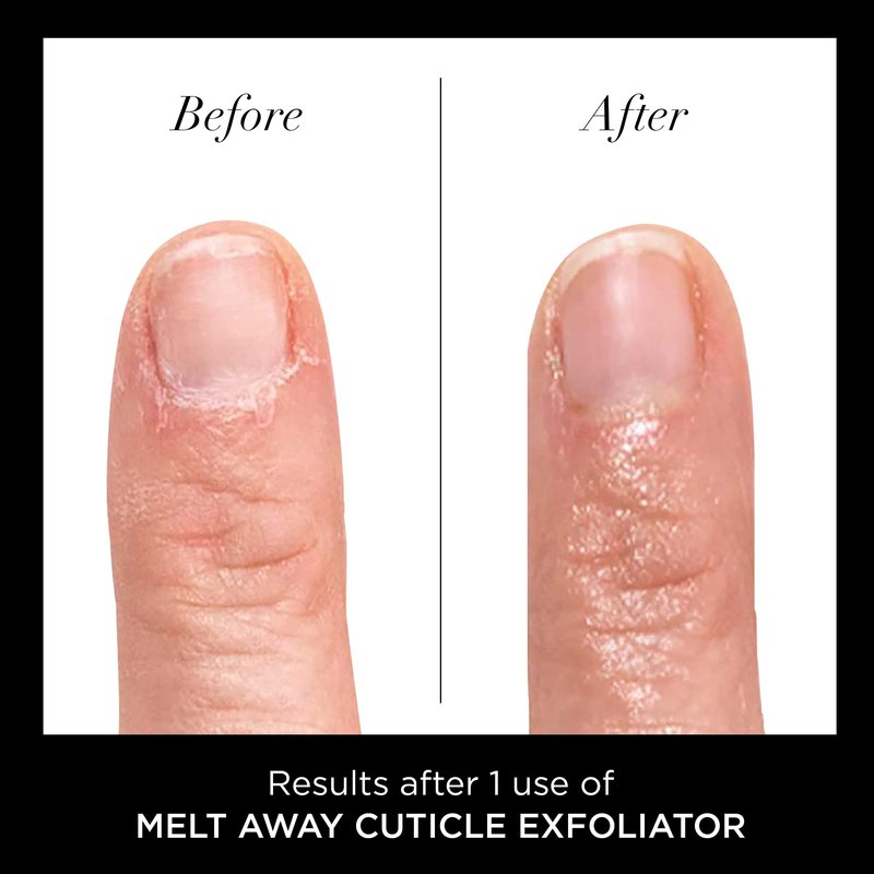 LONDON Cuticle Remover Liquid, Melt Away - Cuticle Softener Oil Exfoliator Gently Removes Dry & Overgrown Skin - Nail Care for Clean & Healthy-Looking Nails, Home Manicure & Pedicure, 6ml