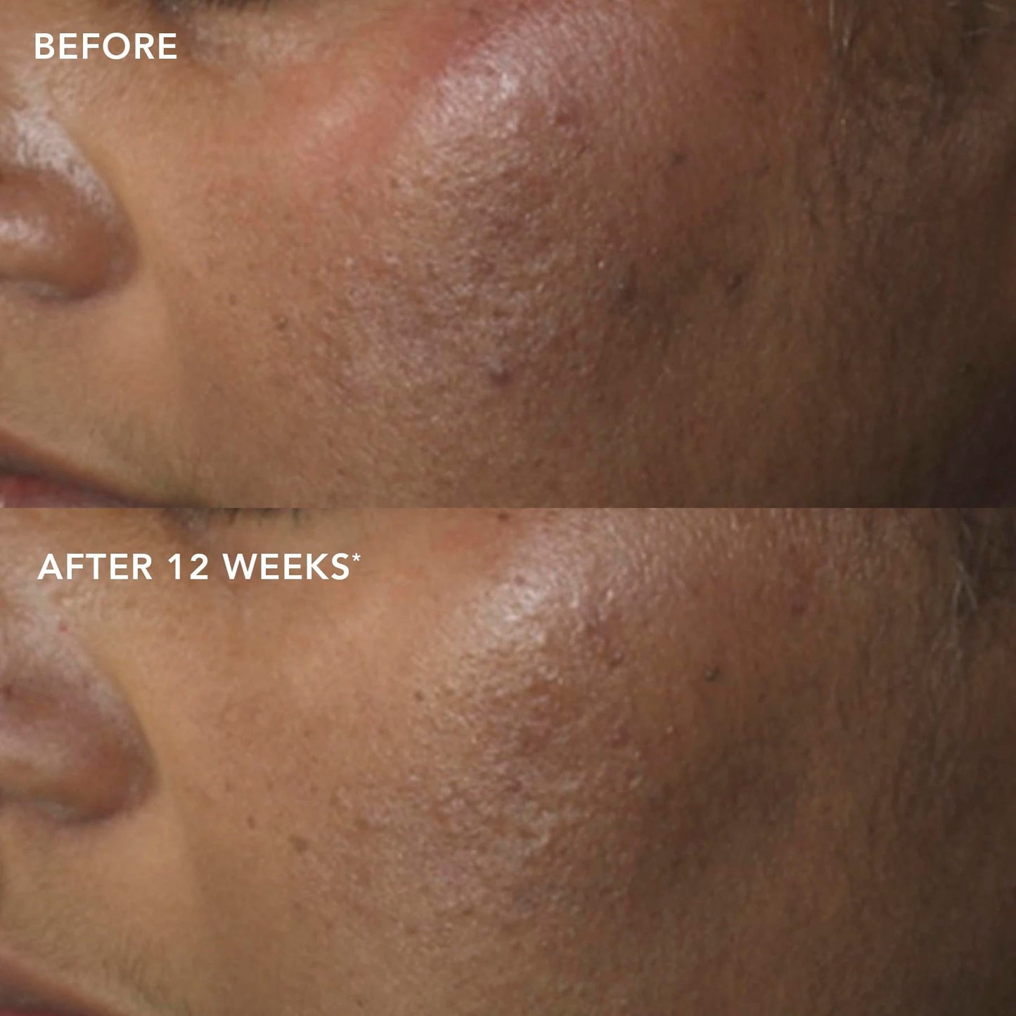 IMAGE Skincare, IMAGE MD Restoring Power-C Serum, 20% Vitamin C, Ferulic Acid Facial Serum to Reduce Pigmentation, Firm, Brighten Skin, 1 fl oz