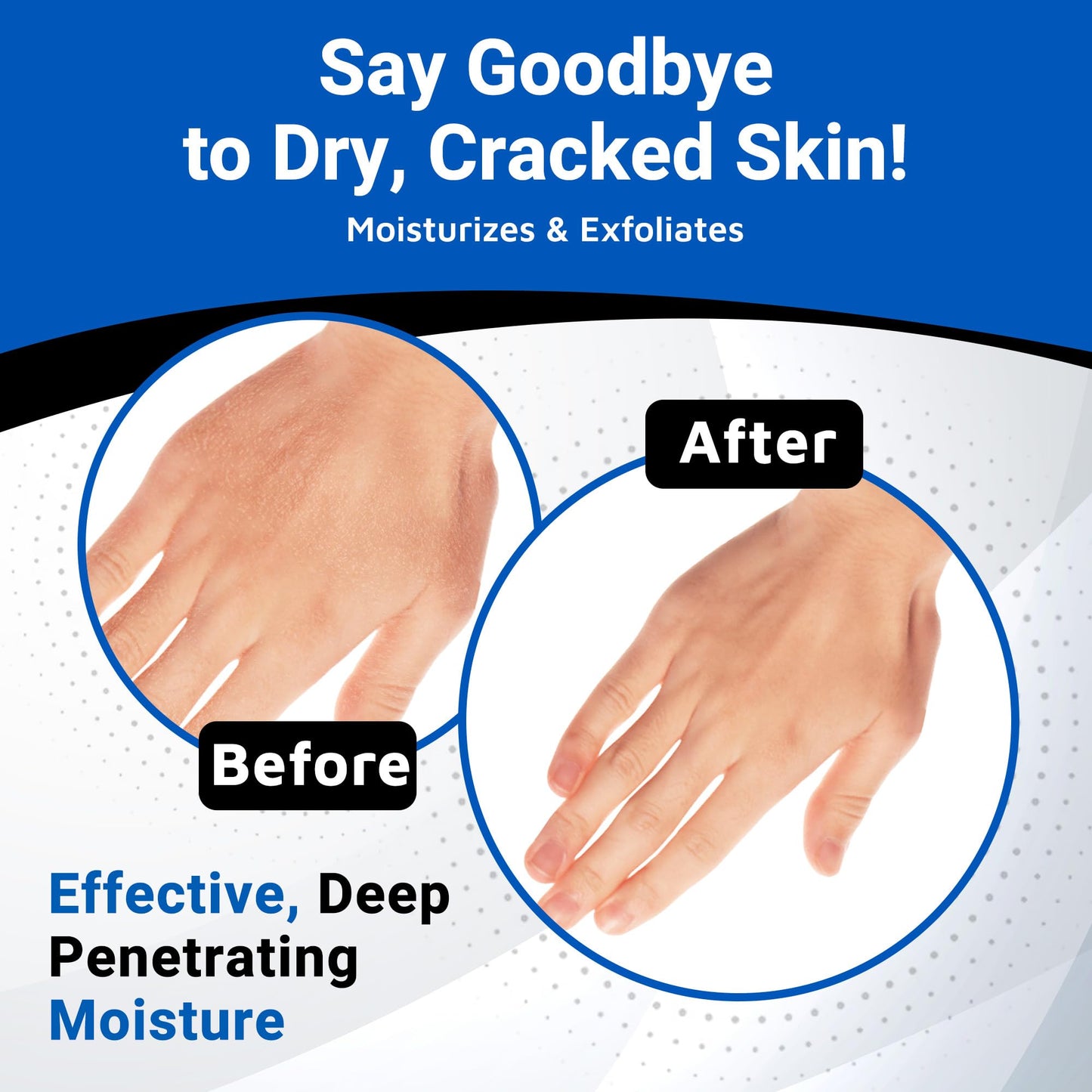 Dermal Therapy Alpha Hydroxy Lotion – 10% Urea + 10% Lactic Acid, Fragrance-Free Body Lotion for Dry, Cracked Skin, Non-Greasy Exfoliating Moisturizer & Keratosis Pilaris Treatment, 16 fl oz (474 ml)
