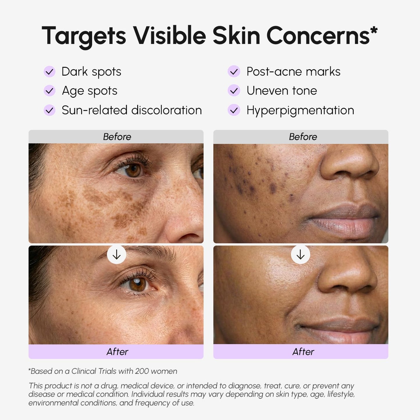 MAREE Dark Spot Remover for Face and Body – Dark Spot Corrector Serum – Hyperpigmentation, Melasma, Sun & Age Spots – Black & Brown Spot Remover for Women – Deep Hydration Body & Face Serum