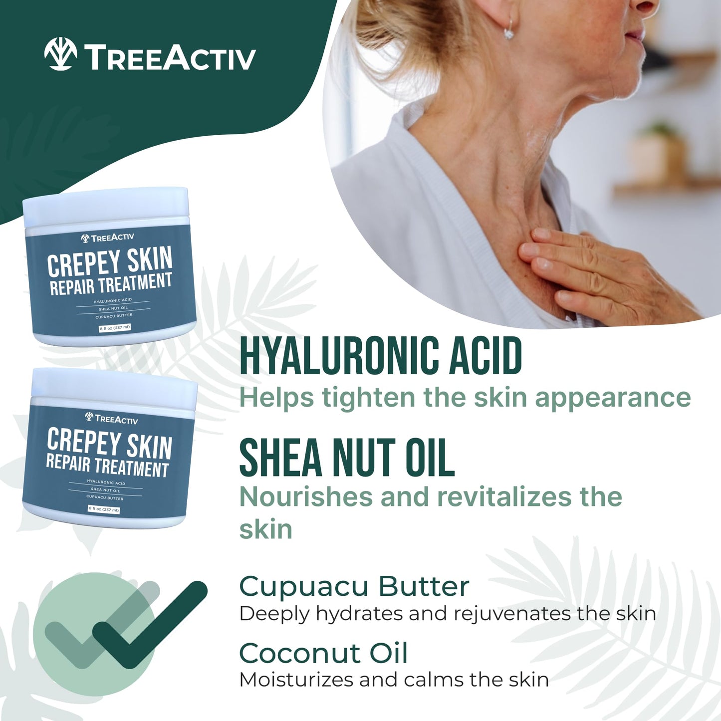TreeActiv Crepey Skin Repair Cream Original Formula, 8 fl oz, Firming Cream For Face & Neck, Skin Firming Lotion with Hyaluronic Acid, Crepey to Address Dry Crepe