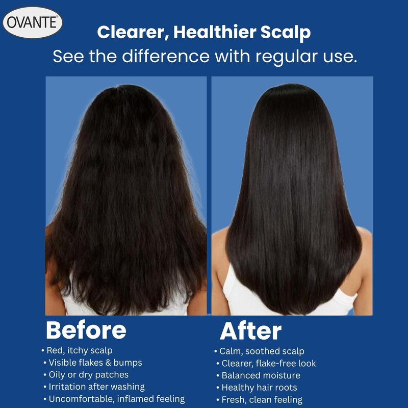 OVANTE Folliculit Solution Shampoo for Men & Women With Scalp Folliculitis - 6 oz