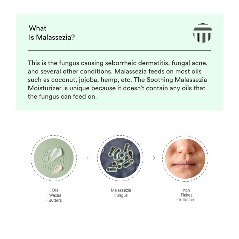 Dermazen Soothing Face Moisturizer | For Dry, Flaky, Itchy Skin | Steroid-Free | Malassezia-Safe | Lactic Acid, Niacinamide & Hyaluronic Acid | Gentle MCT Oil Hydration