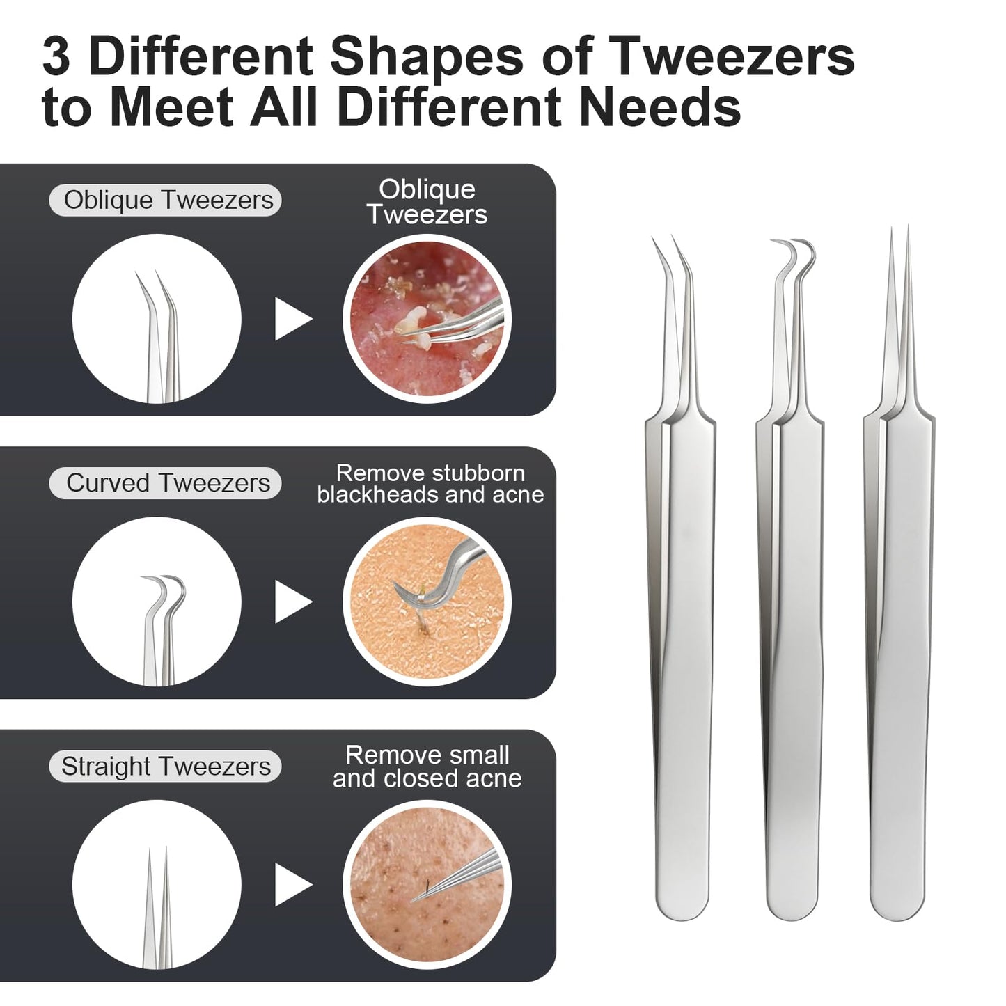 8PCS Professional Salon Grade Blackhead Remover Tool Kit, Comedone Extractor Set for Facial Acne Pimple Blemish Whitehead, Comes with 10X Magnifying Mirror & 20 Alcohol Prep Pads