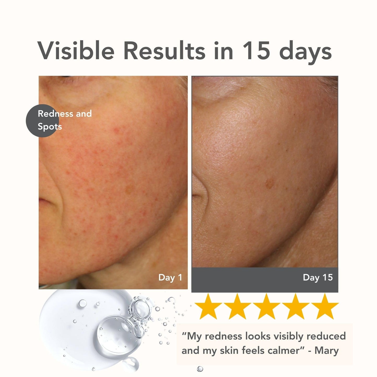 Riversol Rosacea Treatment for Face | Anti-Redness Serum for Sensitive Skin | Calming Redness Relief | Vitamin C & E | Anti-Aging Formula | Fragrance Free | Dermatologist Developed | Made in Canada
