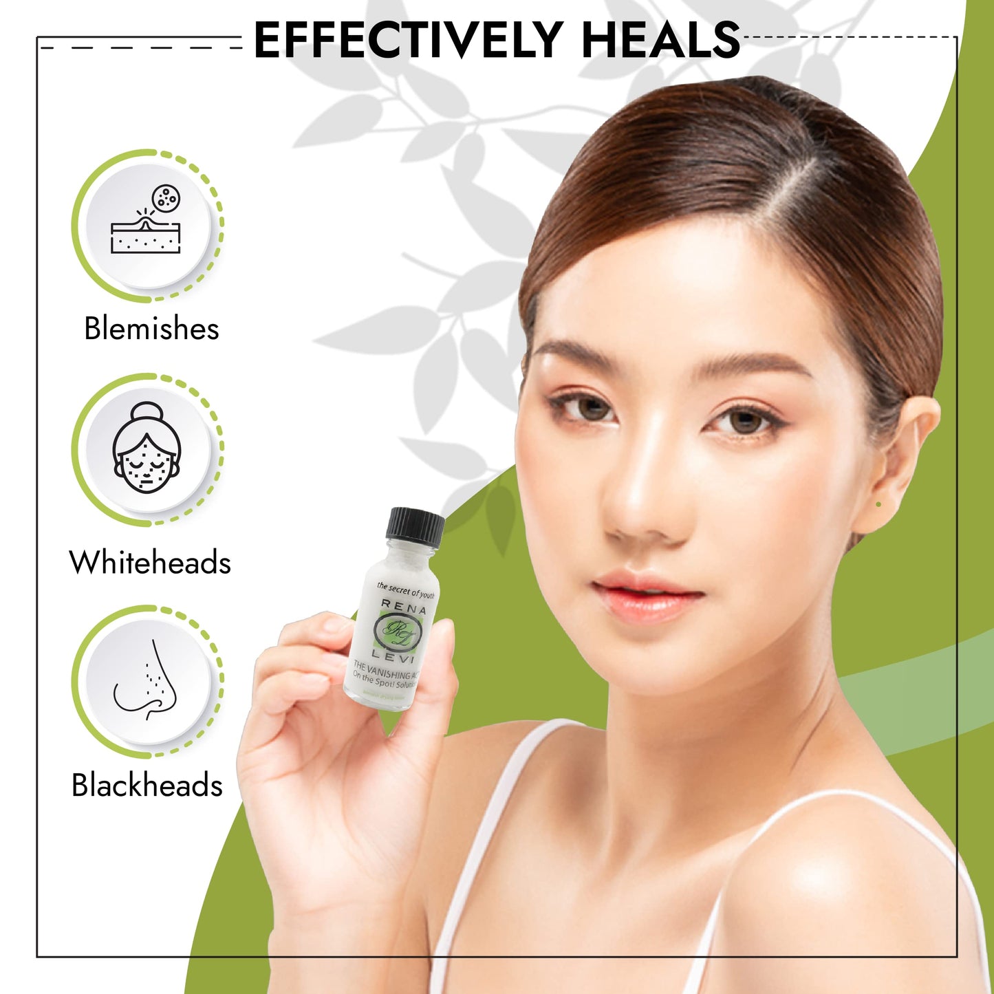 Rena Levi Acne Spot Pimple Drying Lotion - For Face and Body Use, Dries Out Blemishes and Pores - 1oz