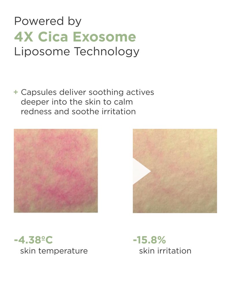 AROCELL Cica Hydrogel PDRN Mask with Panthenol & Centella Asiatica, Cooling Hydrogel Face Mask for Soothing Calming Hydrating Moisturizing Sensitive Skin Korean Skincare, 25gx7ea