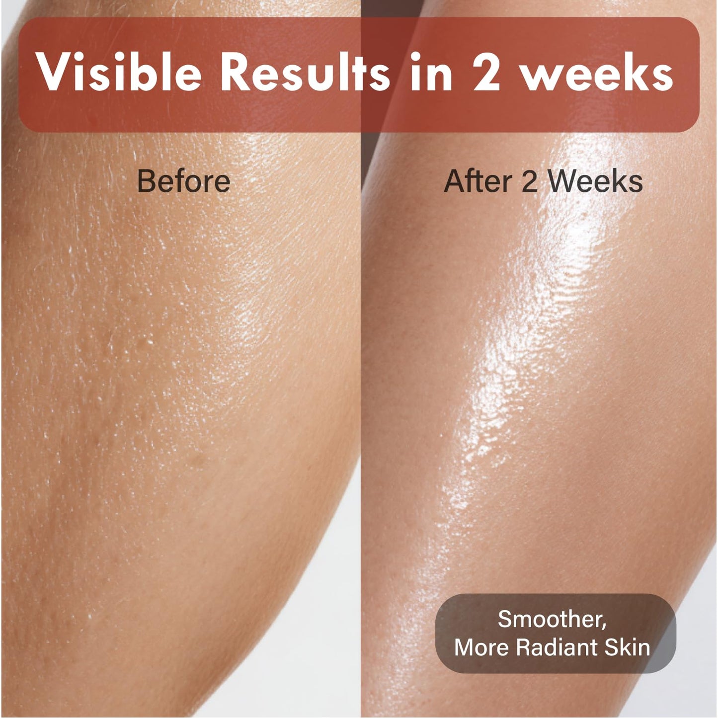 OHMIA Korean Red Bean Body Lotion - 24-Hour Hydrating Moisturizer for Dry Skin with Peptides & Hyaluronic Acid for Smooth Sensitive Skin Women & Men - Vegan & Cruelty-Free - 8.45 fl oz