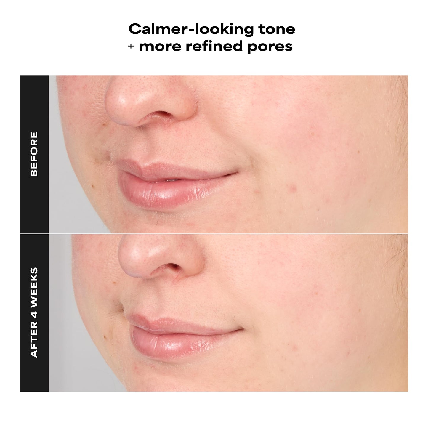 Paula’s Choice CALM 1% Sensitive Skin BHA Exfoliant, Salicylic Acid Lotion for Large, Clogged Pores, Calms, Soothes Redness, Suitable for Rosacea-Prone, Eczema-Prone Skin, Fragrance-Free, 3.3oz