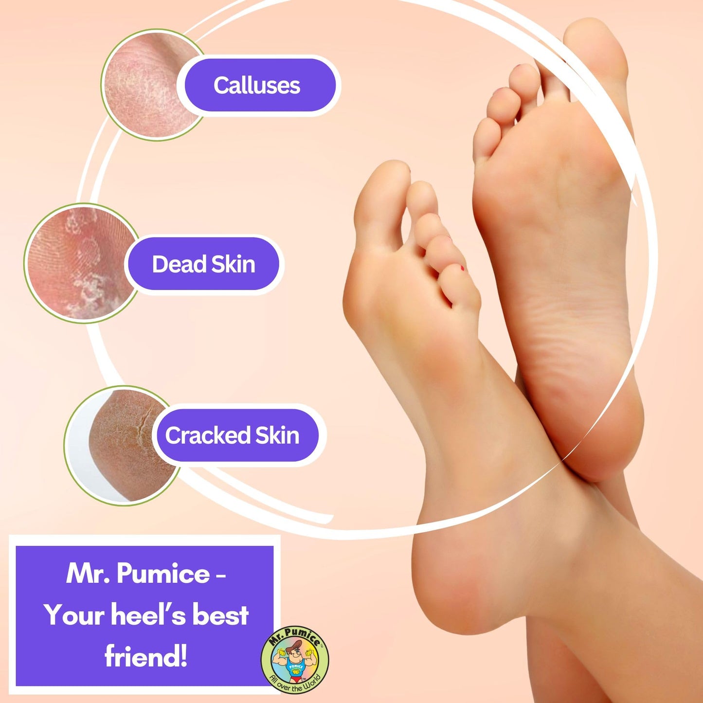 Mr. Pumice Ultimate PUMI Bar 2-in-1 Dual Grit (Medium + Coarse) Callus Remover, Pedicure Stone & Ped File Scrubber for Smooth Feet and Heels (4 Pack)