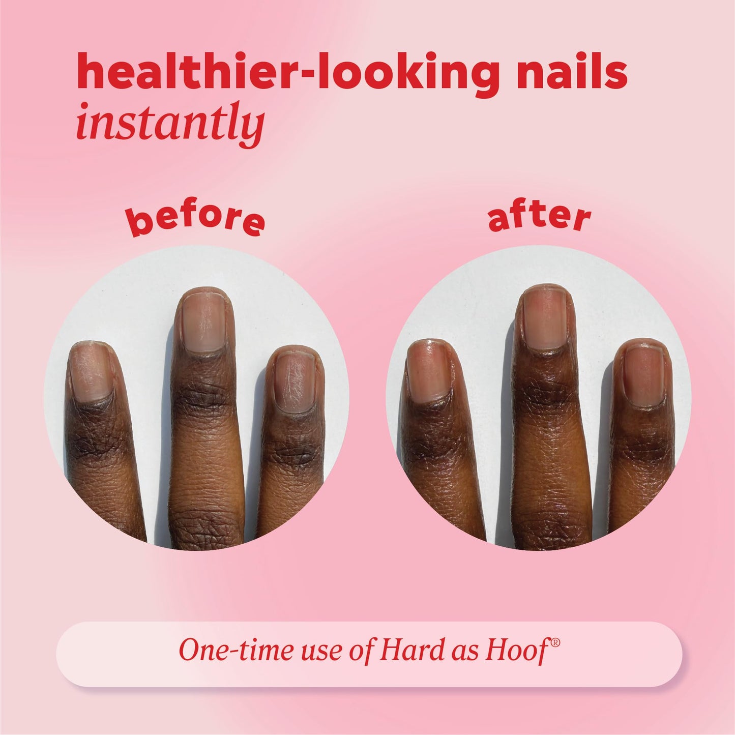 Onyx Professional Hard as Hoof Nail Strengthening Cream, Shea Butter Scent - Nail Growth & Conditioning Cuticle Cream Stops Splits, Chips, Cracks & Strengthens Nails, 1 oz