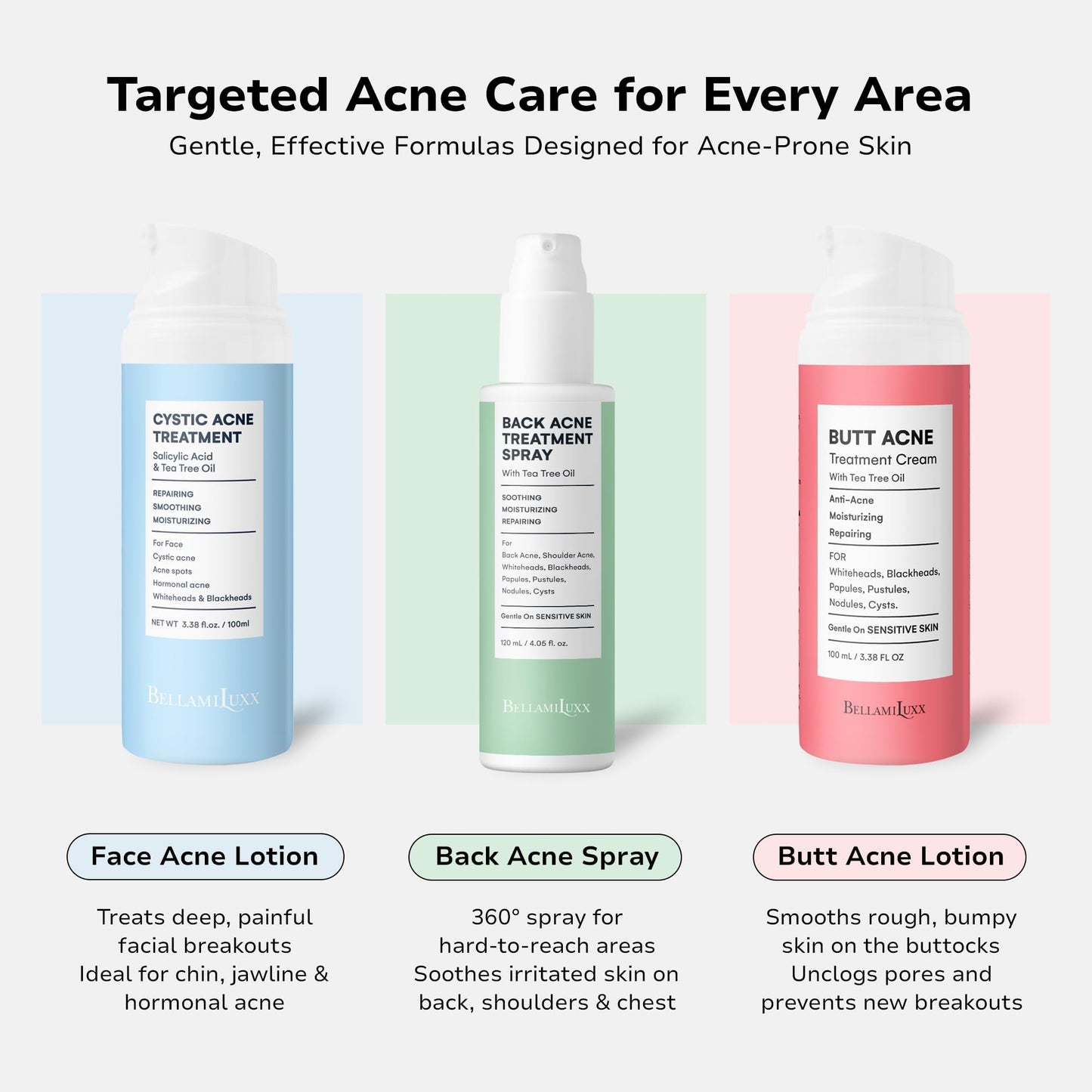 BellamiLuxx Fungal Acne Treatment Lotion: Effective Face & Body Pimple Cream for Bumps, Clusters, Itch & Redness – Fungal Prone Skin Acne Treatment Moisturizer for Teens & Adults with Natural Actives